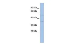 Anti-ABHD15 antibody, Internal used in Western Blot (WB). GTX45523