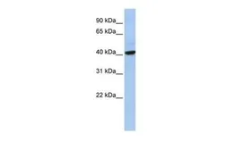 Anti-THAP5 antibody, Internal used in Western Blot (WB). GTX45532