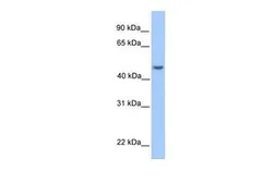 Anti-ASB6 antibody, Internal used in Western Blot (WB). GTX45549