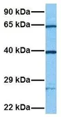 Anti-2'-PDE antibody, Internal used in Western Blot (WB). GTX45550
