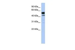 Anti-LDHD antibody, Internal used in Western Blot (WB). GTX45601