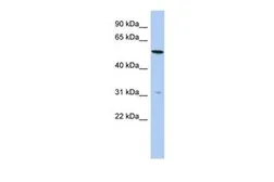 Anti-TMEM161B antibody, N-term used in Western Blot (WB). GTX45605