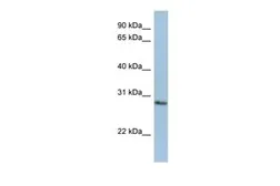 Anti-NANP antibody, Internal used in Western Blot (WB). GTX45629