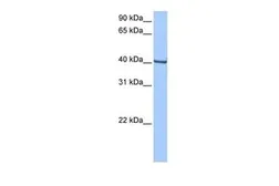 Anti-GBX1 antibody, Internal used in Western Blot (WB). GTX45850