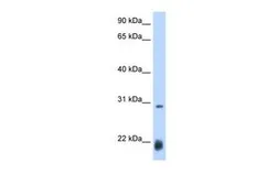 Anti-AC antibody, N-term used in Western Blot (WB). GTX45854