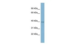 Anti-C16ORF48 antibody, Internal used in Western Blot (WB). GTX45863