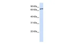 Anti-UNC5A antibody, Internal used in Western Blot (WB). GTX45875