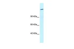 Anti-ARID4A antibody, C-term used in Western Blot (WB). GTX45913
