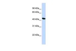 Anti-TMEM117 antibody, Internal used in Western Blot (WB). GTX45929
