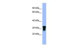 Anti-GI24 antibody, N-term used in Western Blot (WB). GTX46021