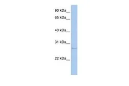 Anti-MDM1 antibody, N-term used in Western Blot (WB). GTX46064