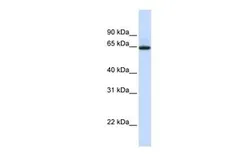 Anti-UGT1A7 antibody, N-term used in Western Blot (WB). GTX46071