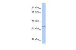 Anti-GSTO2 antibody, Internal used in Western Blot (WB). GTX46115