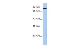 Anti-TMTC1 antibody, Internal used in Western Blot (WB). GTX46122