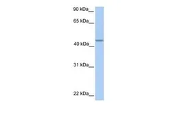 Anti-PNPLA5 antibody, C-term used in Western Blot (WB). GTX46144