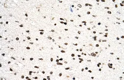 Anti-PGS1 antibody, C-term used in IHC (Paraffin sections) (IHC-P). GTX46171