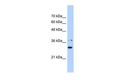 Anti-NMNAT1 antibody, N-term used in Western Blot (WB). GTX46173