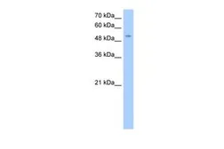 Anti-MFNG antibody, Internal used in Western Blot (WB). GTX46214
