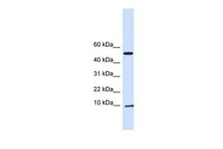 Anti-ATPIF1 antibody, N-term used in Western Blot (WB). GTX46233