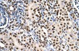 Anti-RSU1 antibody, C-term used in IHC (Paraffin sections) (IHC-P). GTX46246