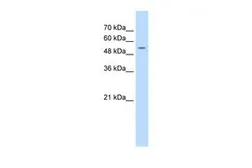 Anti-FJX1 antibody, N-term used in Western Blot (WB). GTX46375