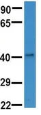 Anti-HS3ST3B1 antibody, N-term used in Western Blot (WB). GTX46416