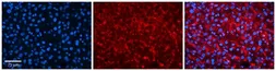 Anti-TSPAN31 antibody, Internal used in IHC (Paraffin sections) (IHC-P). GTX46417