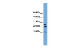 Anti-NNAT antibody, Internal used in Western Blot (WB). GTX46423