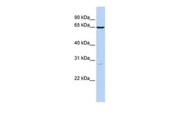 Anti-HAS3 antibody, N-term used in Western Blot (WB). GTX46425
