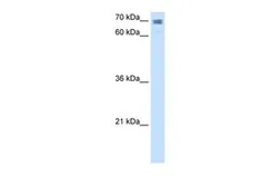 Anti-CLGN antibody, N-term used in Western Blot (WB). GTX46439