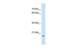 Anti-ASF1B antibody, Internal used in Western Blot (WB). GTX46463