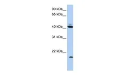 Anti-FAT10 antibody, N-term used in Western Blot (WB). GTX46478