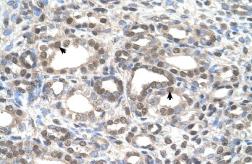Anti-DFNA5 antibody, C-term used in IHC (Paraffin sections) (IHC-P). GTX46489