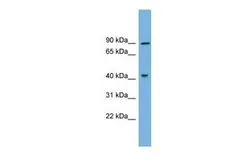Anti-DYRK1A antibody, N-term used in Western Blot (WB). GTX46524