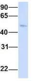 Anti-CHST1 antibody, Internal used in Western Blot (WB). GTX46545