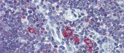 Anti-TFR2 antibody, Internal used in IHC (Paraffin sections) (IHC-P). GTX46552