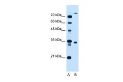 Anti-FLJ22167 antibody, N-term used in Western Blot (WB). GTX46584