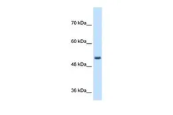 Anti-SPPL2B antibody, N-term used in Western Blot (WB). GTX46586