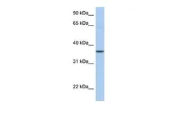 Anti-LFNG antibody, N-term used in Western Blot (WB). GTX46596
