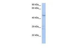 Anti-ACPL2 antibody, Internal used in Western Blot (WB). GTX46615