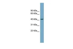 Anti-DNAJC25 antibody, Internal used in Western Blot (WB). GTX46654