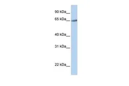 Anti-TM9SF1 antibody, N-term used in Western Blot (WB). GTX46658