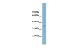 Anti-GPD2 antibody, Internal used in Western Blot (WB). GTX46744