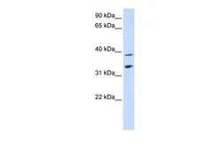 Anti-SLC25A34 antibody, Internal used in Western Blot (WB). GTX46751