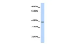 Anti-SLC25A42 antibody, N-term used in Western Blot (WB). GTX46759