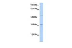 Anti-SLC39A11 antibody, Internal used in Western Blot (WB). GTX46777