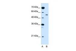 Anti-GLUT10 antibody, Internal used in Western Blot (WB). GTX46790