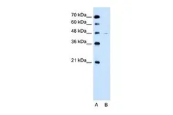 Anti-SLC43A3 antibody, N-term used in Western Blot (WB). GTX46816