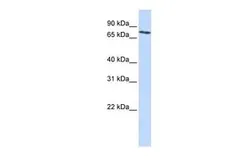 Anti-SLCO2B1 antibody, N-term used in Western Blot (WB). GTX46821