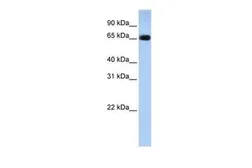 Anti-SLC22A13 antibody, N-term used in Western Blot (WB). GTX46831